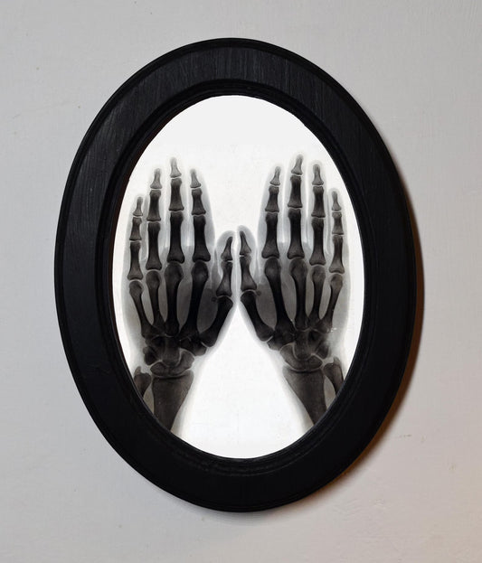 Two Hands X-Ray Radiograph Sir Arthur Schuster Gothic Black Oval Wooden Framed Classic Art Print 3"x4", 3.5"x5", 4"x6", 5"x7", 6"x8"